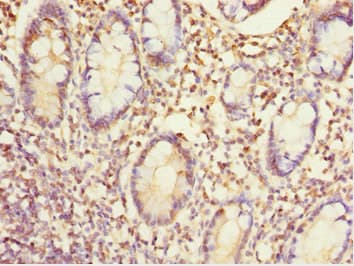 EYA3 Antibody