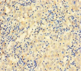 CCDC36 Antibody (aa11-592)