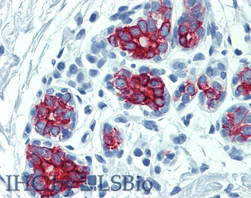 Monoclonal Mouse anti-Human Cytokeratin 7+17 Antibody (clone C-46, IHC, WB)