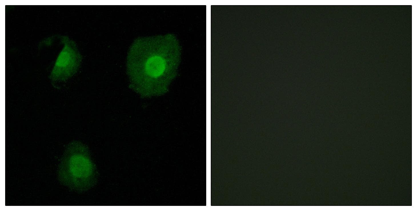 EID1 / EID-1 Antibody