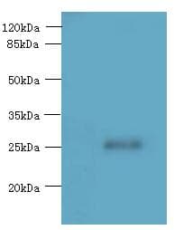 Polyclonal Rabbit anti-Human C16orf48 Antibody (IHC, WB)
