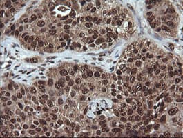 VHL / Von Hippel Lindau Antibody (clone OTI1E1)