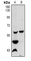 Vimentin Antibody
