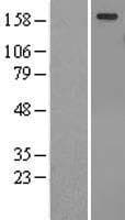 TULP4 Protein (Over-Expression Lysate Myc-DDK (Flag))