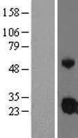 IGFBP4 Protein (Over-Expression Lysate Myc-DDK (Flag))