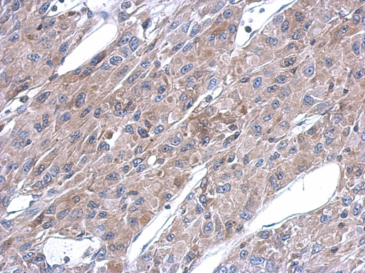 ASL / Argininosuccinate Lyase Antibody (aa13-261)