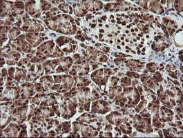 THUMPD1 Antibody (clone OTI1H6)