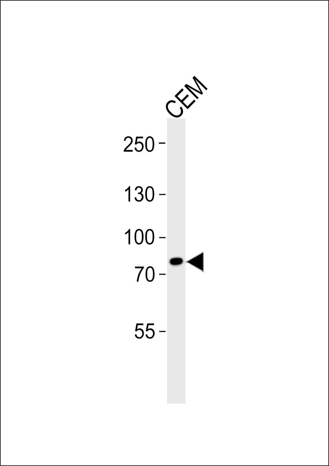 Polyclonal Rabbit anti-Human ACAP3 Antibody (aa759-792, WB)