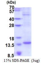 Human BTF3L4 Protein (Recombinant His)