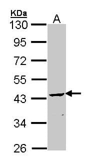 PathPlus™ Polyclonal Rabbit anti-Human CNPase Antibody (IHC, WB)