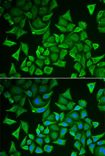 Thymidylate Kinase Antibody