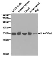 Polyclonal Rabbit anti-Human HLA-DQA1 Antibody (IHC, WB)