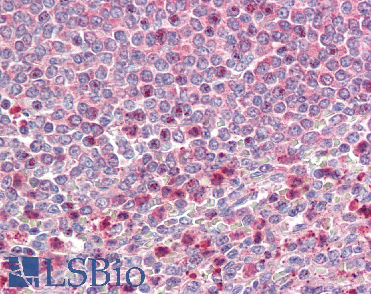 IHC-plus™ UBR4 Antibody (aa5002-5015)
