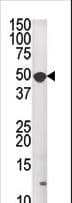 MKNK1 / MNK1 Antibody (aa1-30)