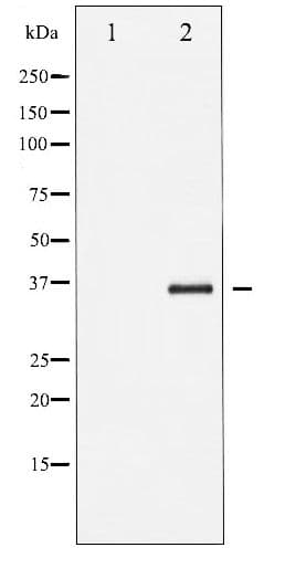 NFKBIB / IKB Beta / IKBB Antibody (phospho-Thr19)