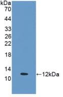 ESR2 / ER Beta Antibody (aa149-213)