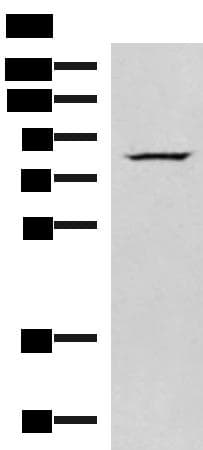 Polyclonal Rabbit anti-Human NASP Antibody (IHC, WB)