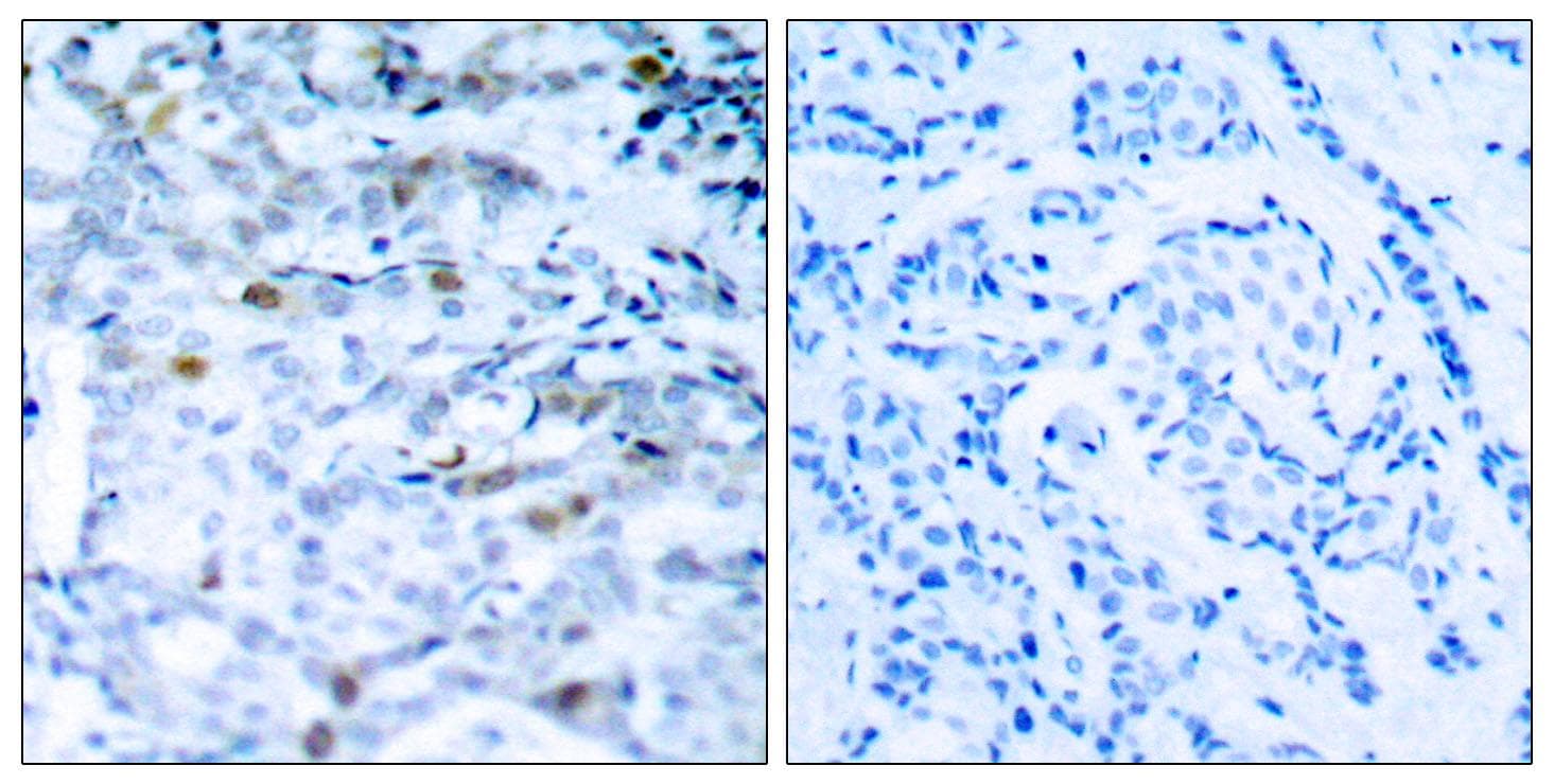 CDK1 / CDC2 Antibody (phospho-Thr161)
