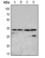 OTUB1 / OTU1 Antibody