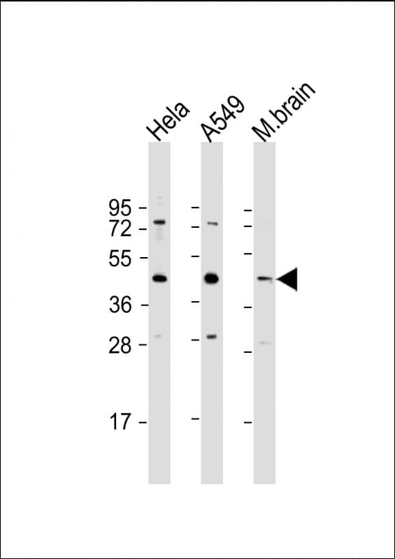SCN4 / G6PC3 Antibody (C-Terminus)