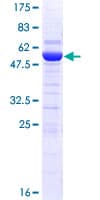 Human DCUN1D1 / SCCRO Protein (Recombinant GST)