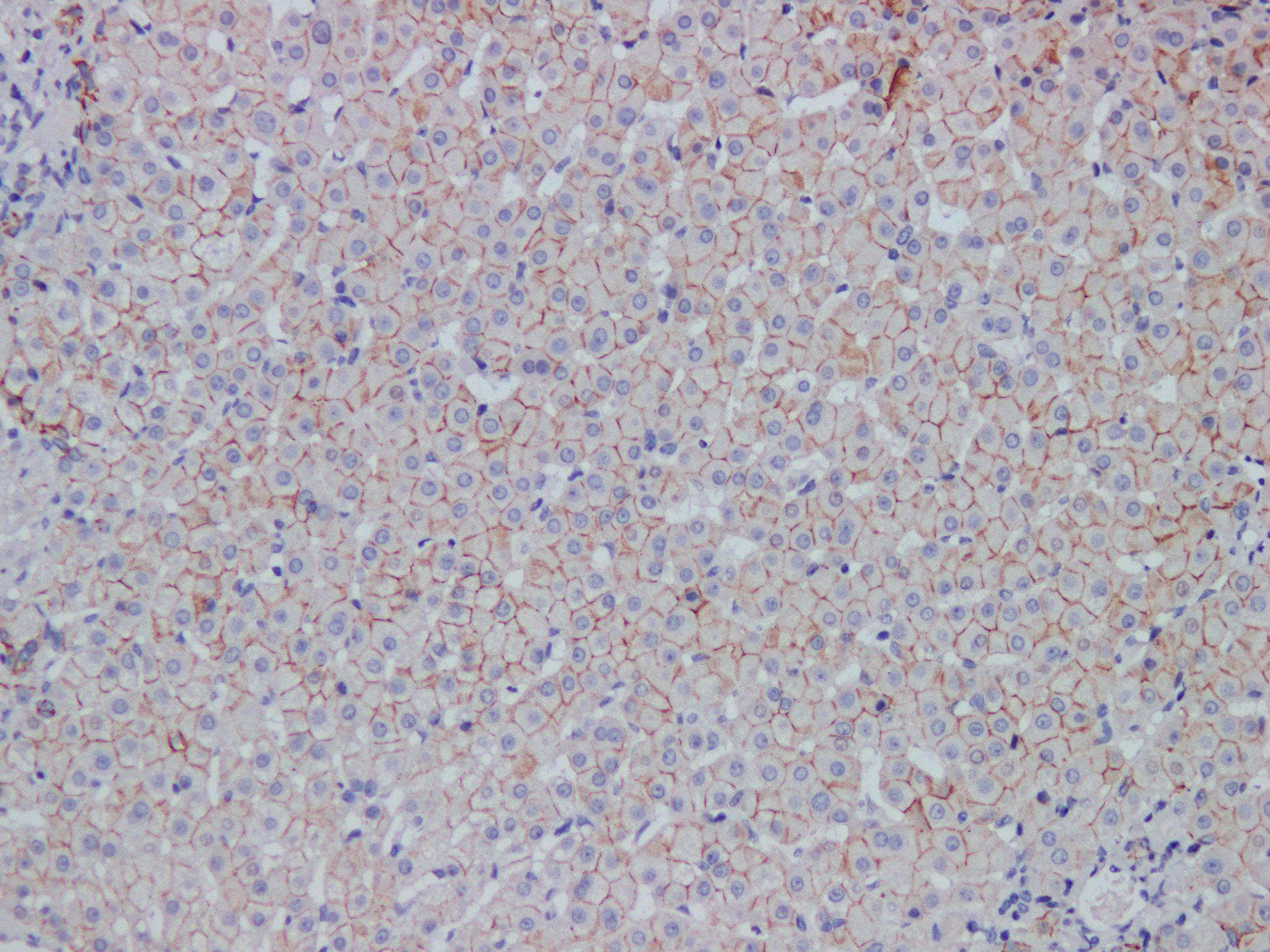 Cadherin Antibody