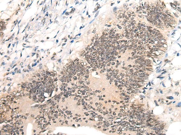 Polyclonal Rabbit anti-Human AURKA / Aurora-A Antibody (IHC)