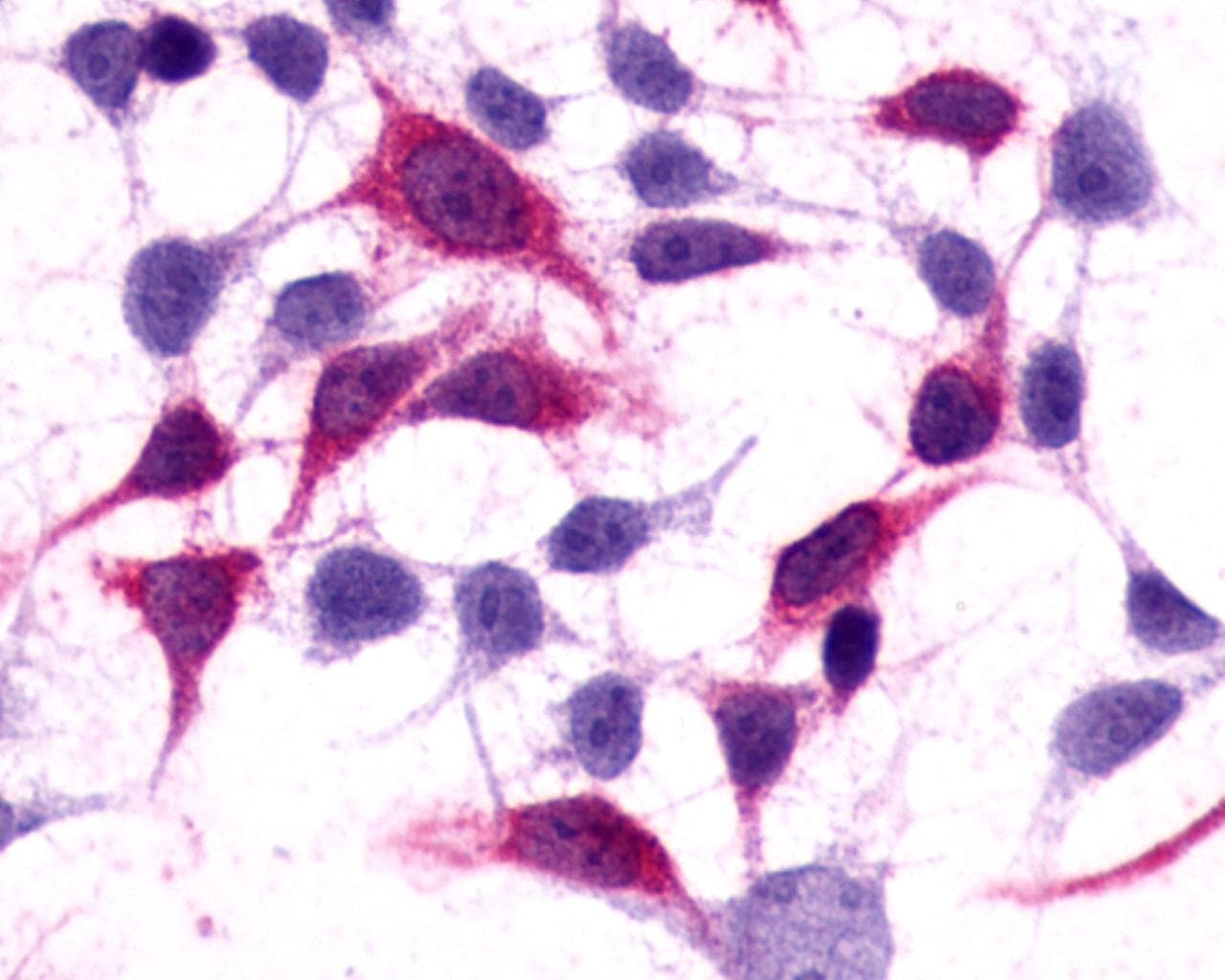 PathPlus™ GRM3 / MGLUR3 Antibody (N-Terminus)