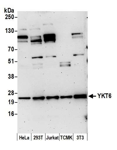 Polyclonal Rabbit anti-Human YKT6 Antibody (aa125-175, WB)