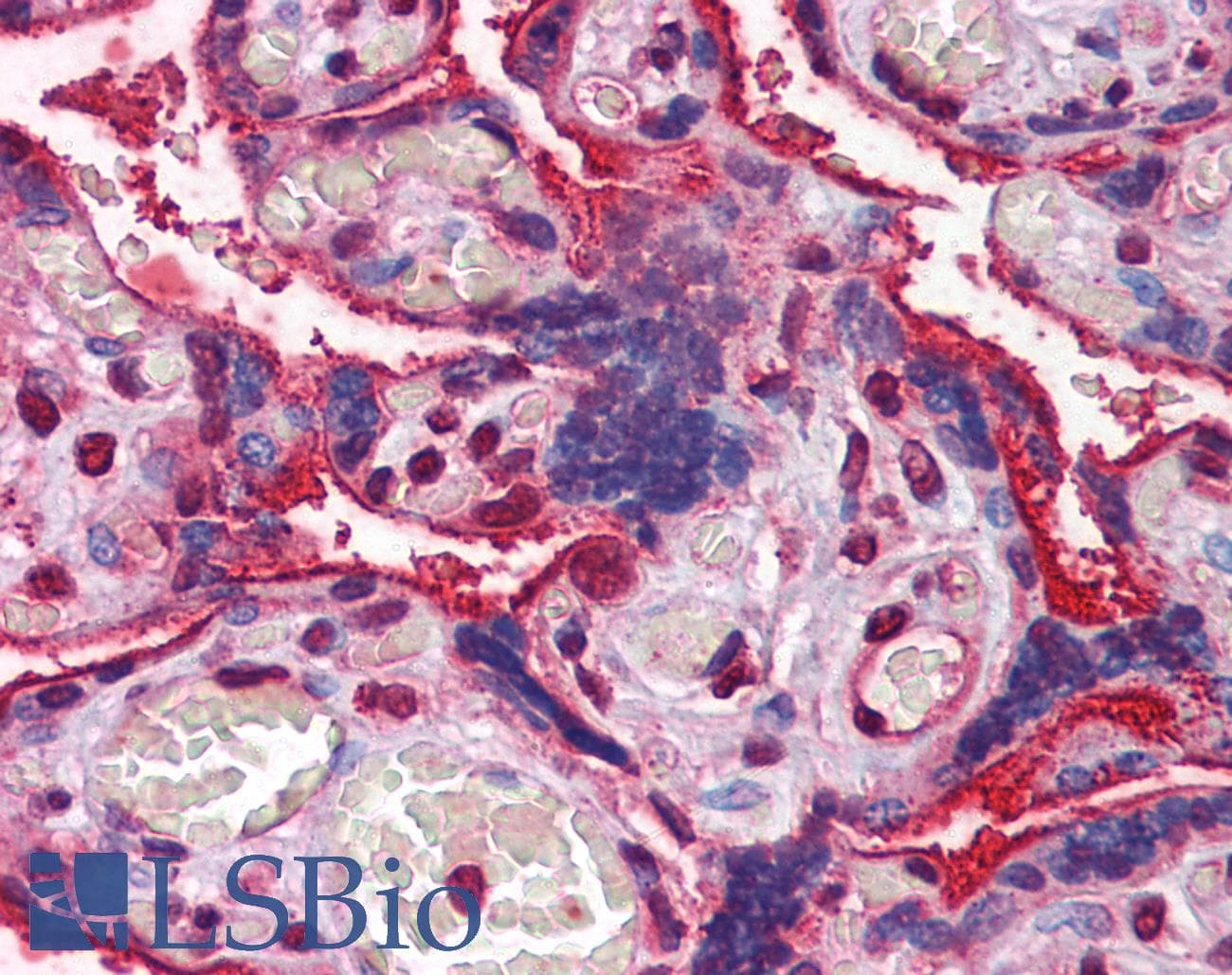 IHC-plus™ Polyclonal Rabbit anti-Human ITGA5/Integrin Alpha 5/CD49e Antibody (C-Terminus, IHC, WB)
