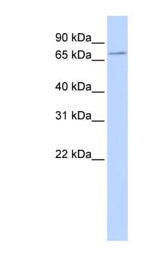 Polyclonal Rabbit anti-Human SLC5A5 / NIS Antibody (aa468-517, WB)
