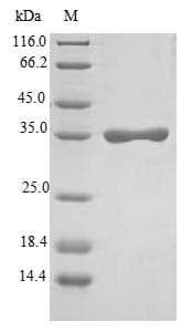 Human FXYD2 Protein (Recombinant GST, N-terminus)