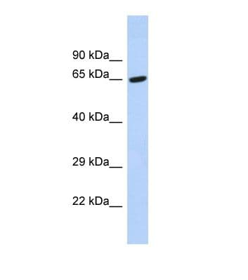Polyclonal Rabbit anti-Human TAF6L Antibody (C-Terminus, WB)