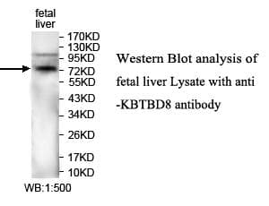 KBTBD8 Antibody (aa180-374)