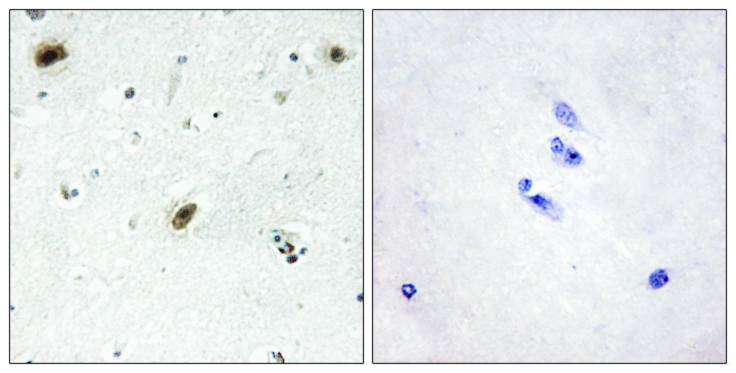 ABL1 / c-ABL Antibody