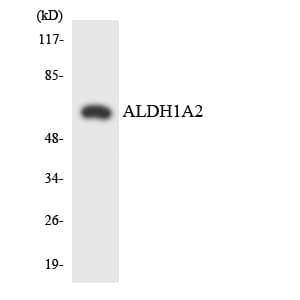 IHC-plus™ RALDH2 / ALDH1A2 Antibody (aa394-443)