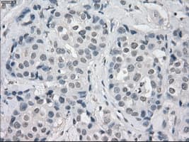AURKC / Aurora C Antibody (clone OTI2B7)