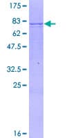 Human CYP3A7 Protein (Recombinant GST)