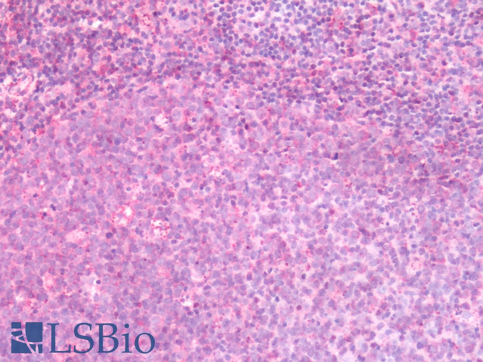 PathPlus™ GPR44 / CRTH2 Antibody (N-Terminus)
