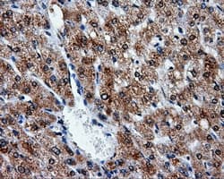 ATP5B / ATP Synthase Beta Antibody (clone OTI6C4)