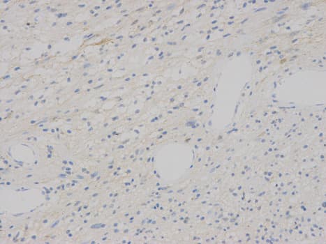 VEGFB Antibody