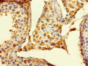 Polyclonal Rabbit anti-Human ALG14 Antibody