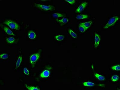 SLC5A10 / SGLT5 Antibody