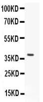 Polyclonal Rabbit anti-Human HOXA9 Antibody (WB)