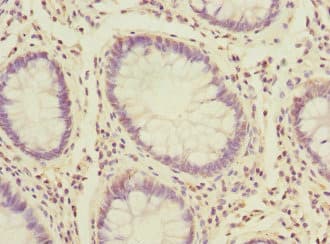 PK2 / PROK2 Antibody