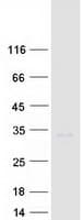 Human HOXA9 Protein (Recombinant Myc-DDK (Flag))