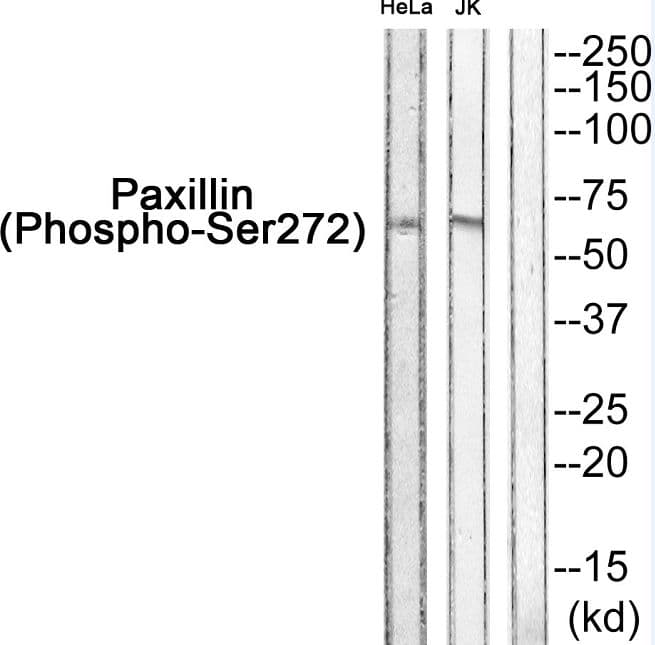 PXN / Paxillin Antibody (phospho-Ser272)