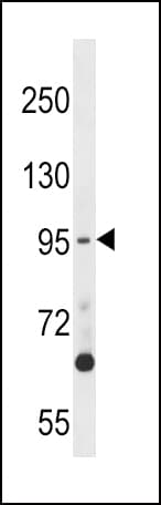 MPS1 / TTK Antibody (aa2-32)
