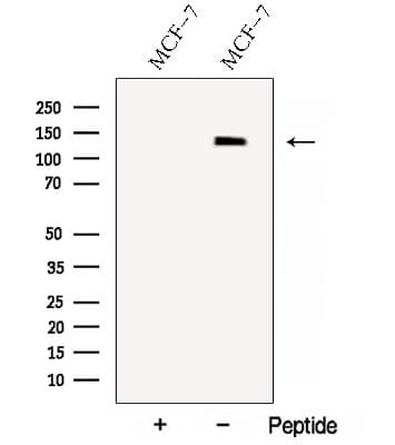 NRDE2 / C14orf102 Antibody