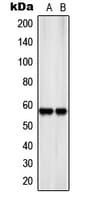 SLC22A17 Antibody (Internal)